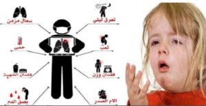 تزامنا مع الأحتفال باليوم العالمى لمكافحة السل 24 مارس،أهم أعراض مرض السل
